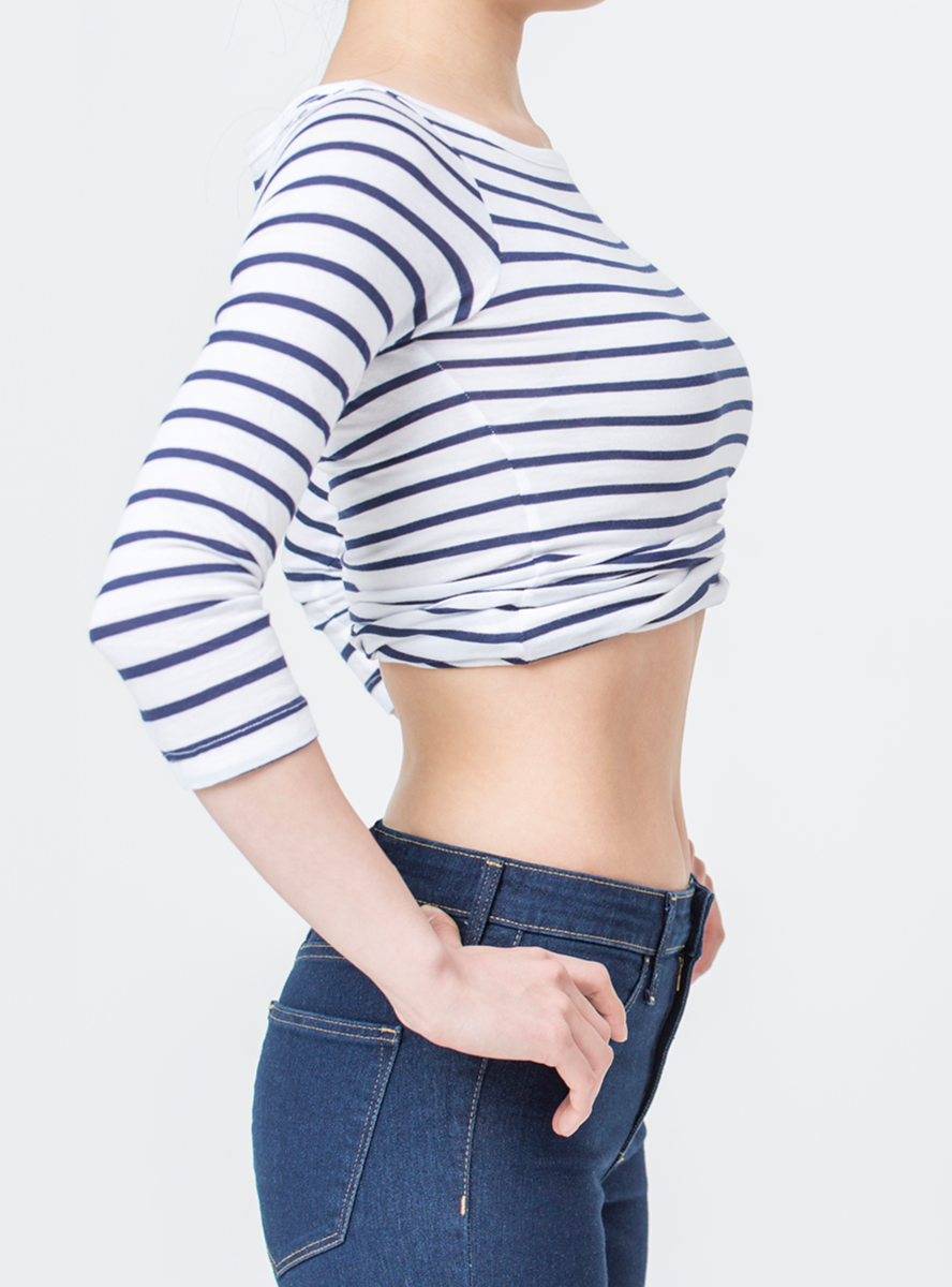 굶지 않는 한방 다이어트로 숨겨진 라인을 찾다 - After