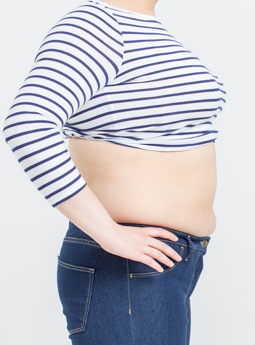 굶지 않는 한방 다이어트로 숨겨진 라인을 찾다 - Before