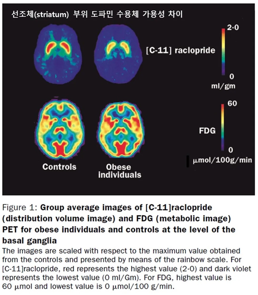 WANG, Gene-Jack, et al. Brain dopamine and obesity. The Lancet, 2001, 357.9253: 354-357.