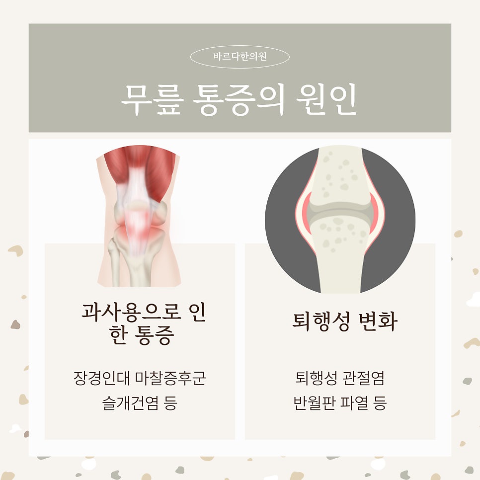 대전 도안동 무릎치료
