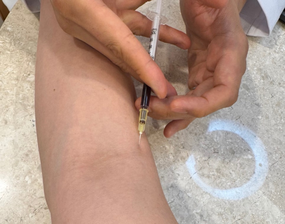 채혈양이 많지 않아, 바늘이 얇고 통증이 거의 별로 없습니다.