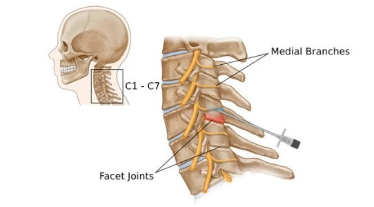 내측지(medial branch)