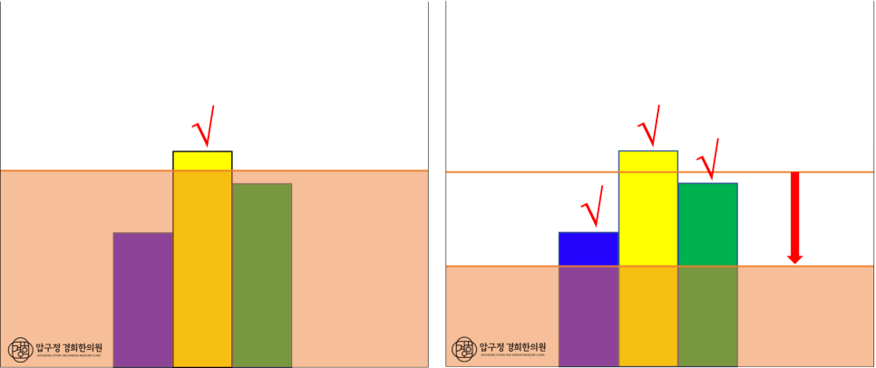 파란색 : 어깨 통증노랑색 : 허리 통증초록색 : 무릎 통증