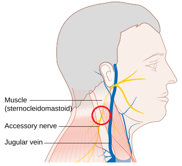 흉쇄유돌근(sternocleidomastoid) 밑으로 지나가는 부신경(accessory nerve)