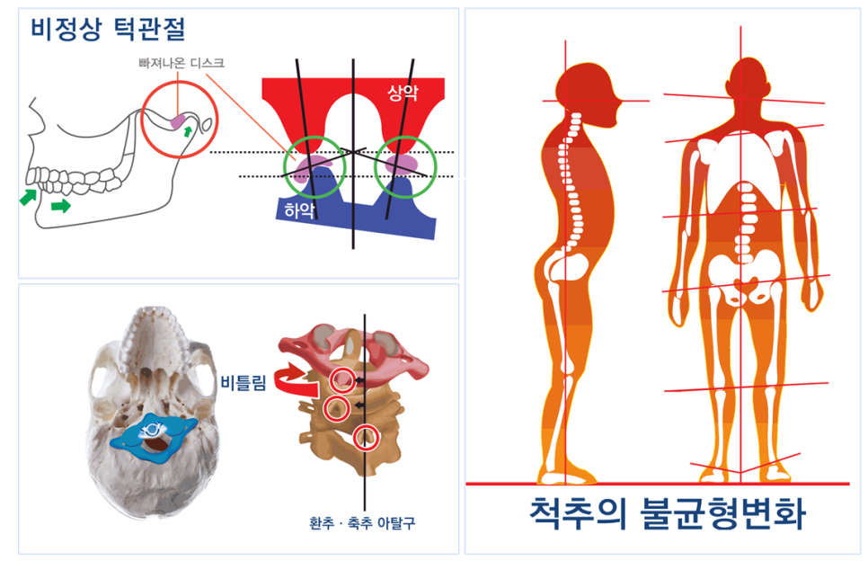 턱관절균형의학연구소 제공