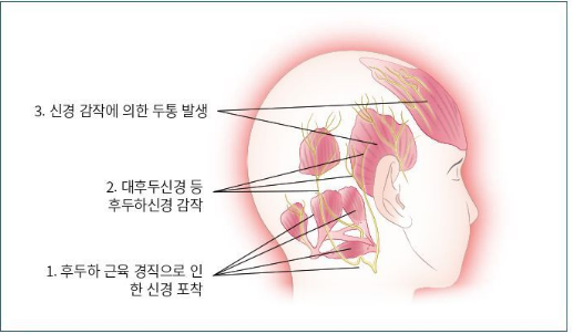 출처: 초음파 가이드 근골격계 통증 치료의 정석