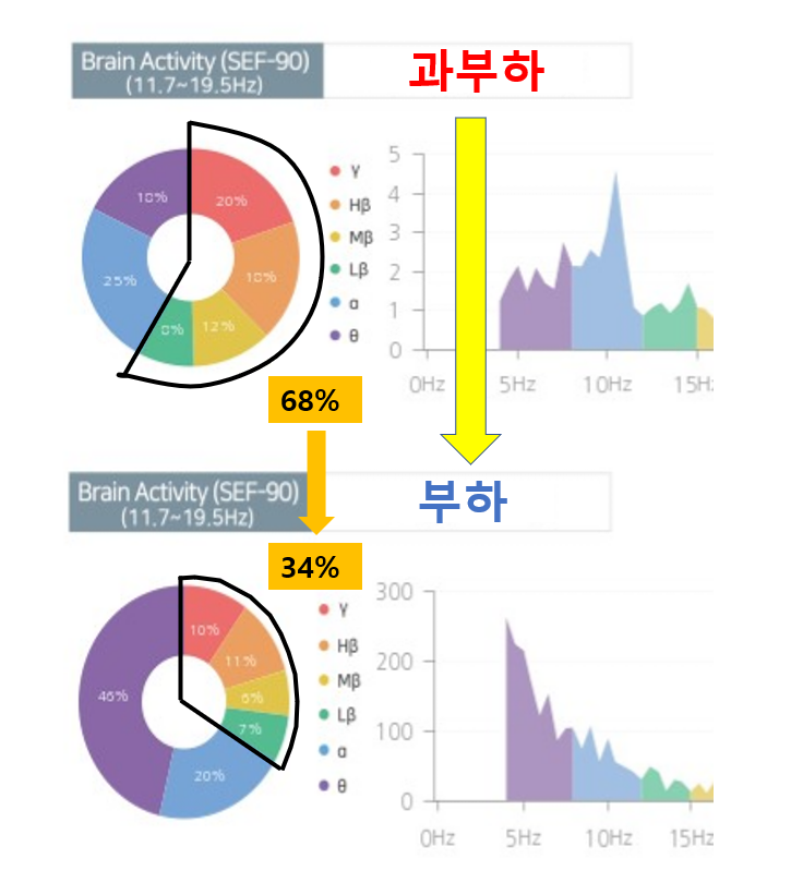 뇌의 부하가 감소했어요
