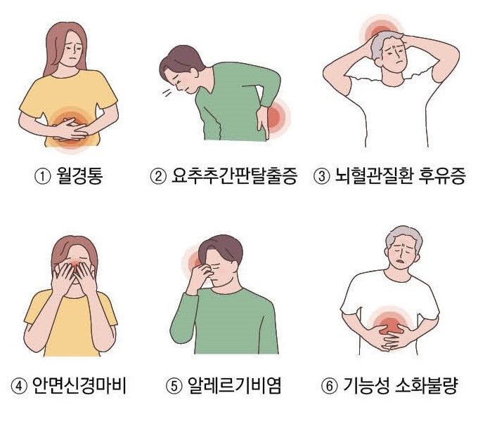 첩약 시범 사업에 해당하는 6가지 질환들