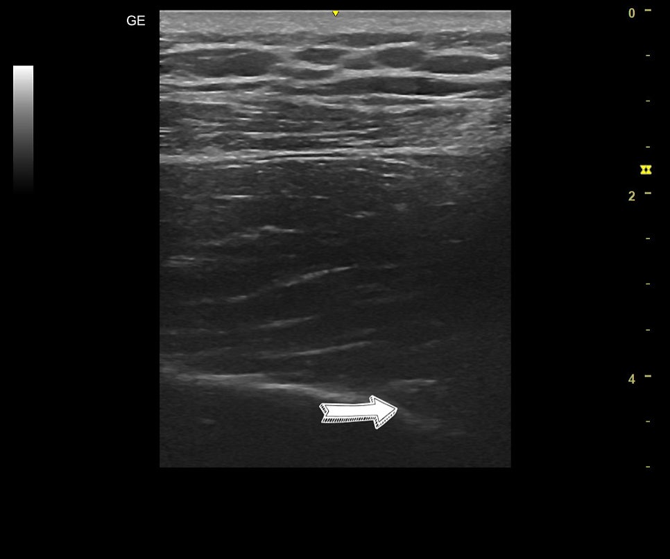 medial->lateral.