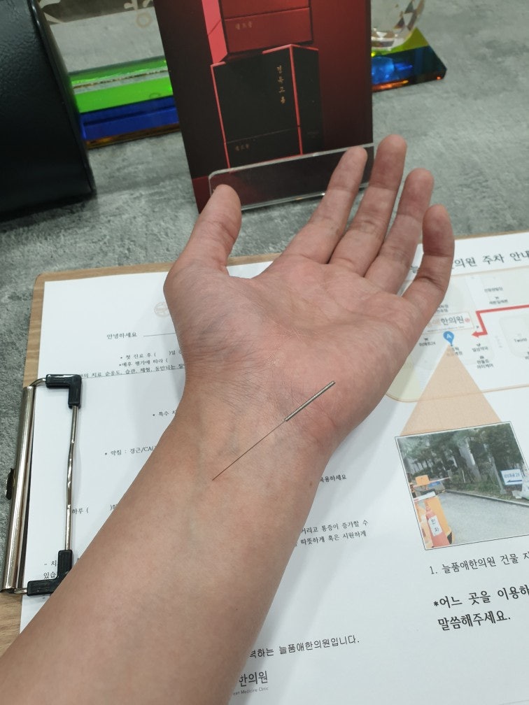 내관혈에 자침한 모습(제손목입니다)