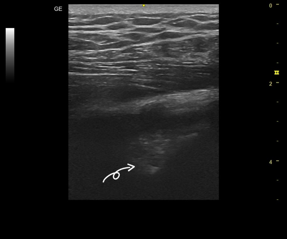 (medial->lateral)