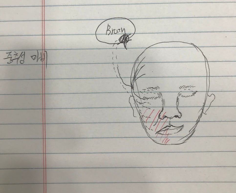 빨간색 빗금이 마비 부위