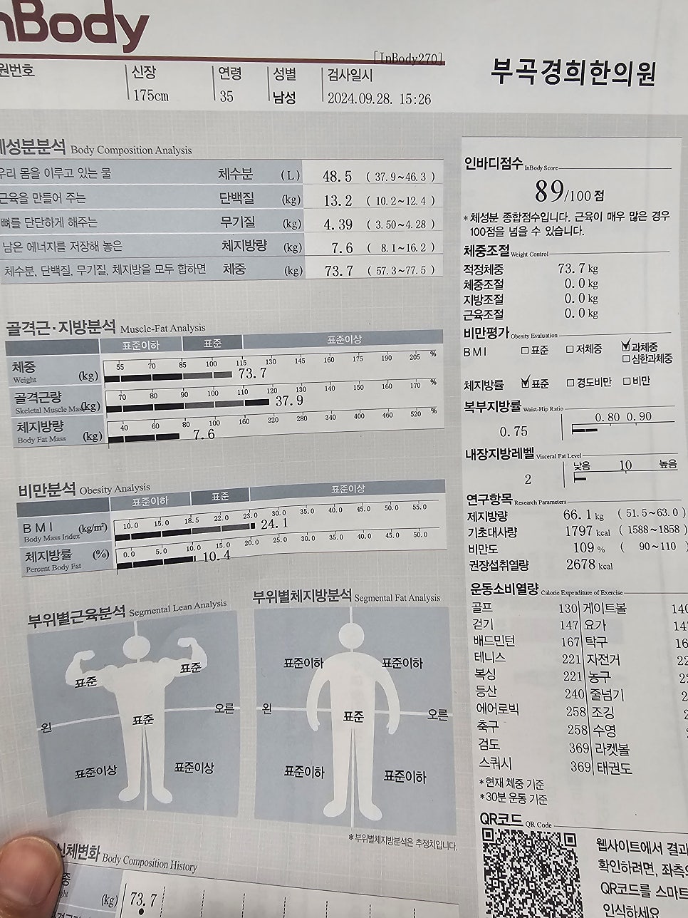 그리고 지금...