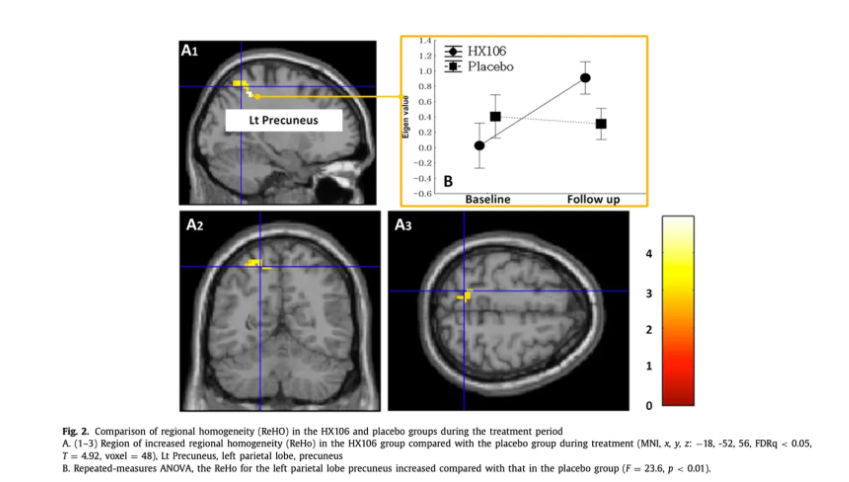 BAE, Sujin; PARK, Sunhye; HAN, Doug Hyun. A mixed herbal extract as an adjunctive therapy for attention deficit hyperactivity disorder: a randomized placebo-controlled trial. Integrative medicine research, 2021, 10.3: 100714. ​