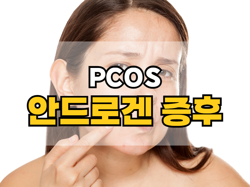 다낭성 난소증후군 증상 1: 안드로겐 증후