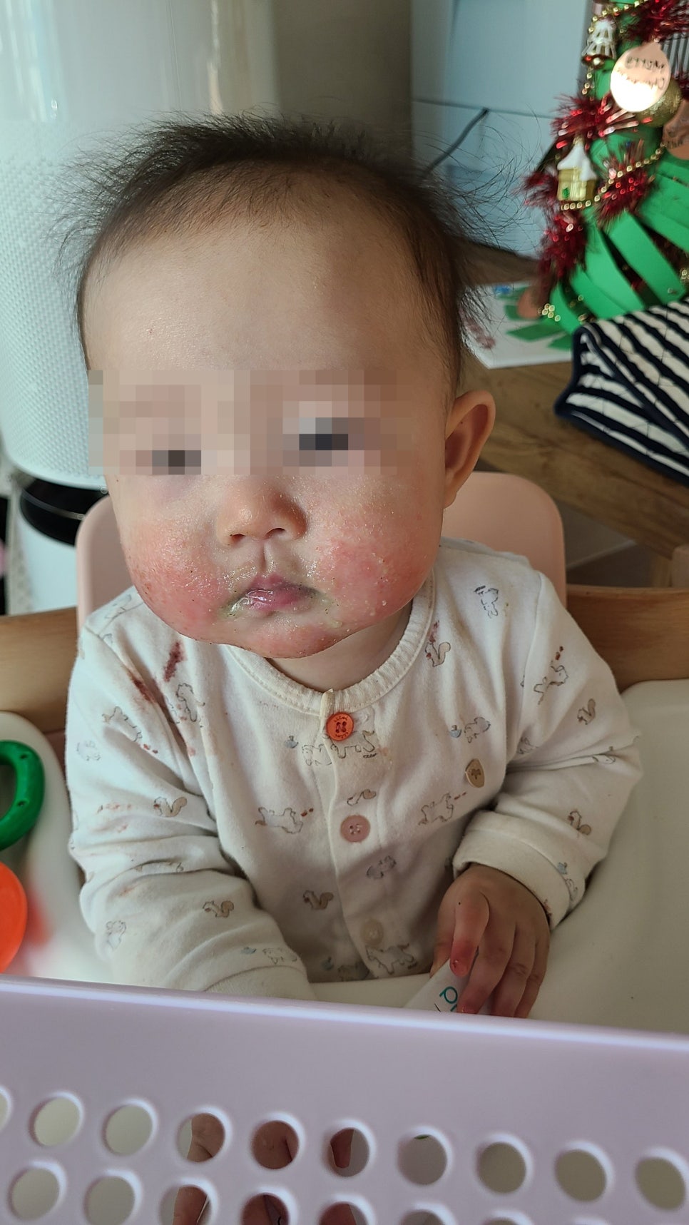 상처난 피부에 음식물이 최대한 뭍지 않게 해야하는데, 아무런 생각이 없었다.
