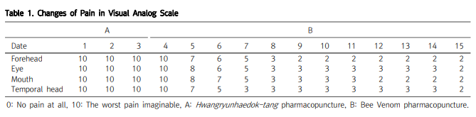 양태준 ( Tae Jun Yang ),이정훈 ( Jeong Hun Lee ),김선욱 ( Seon Wook Kim ),정주용 ( Joo Yong Jeong ),and 위통순 ( Tung Shuen Wei ). "삼차신경통에 대한 봉약침을 병행한 한방치료 치험 1예." Korean Journal of Acupuncture 31.4 (2014): 225-228.