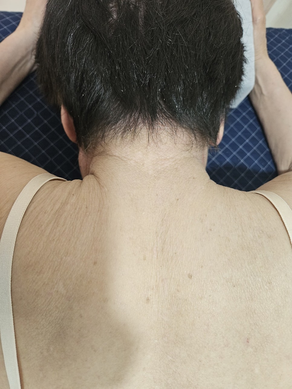 두피쪽이 아직 각질이 남아있는 모습입니다. 두피가 마지막 관문으로 남아계세요 ㅎㅎ