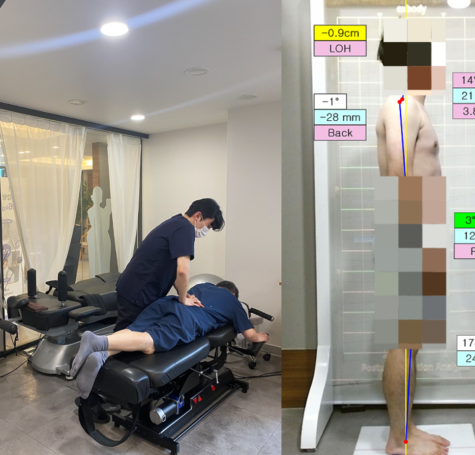 틀어진 골격이 어깨결림, 두통, 머리 멍함 등 다양한 증상을 가져올 수 있습니다. 평소 다리를 꼬거나, 한 자세로 오래 앉아 있는 습관을 지양하는 게 좋습니다.