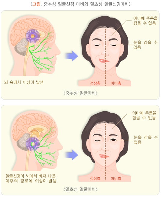 <출처: 국가건강정보포털>