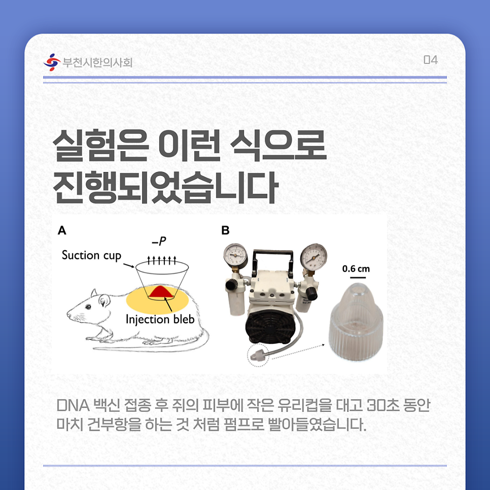코로나 부항 효과