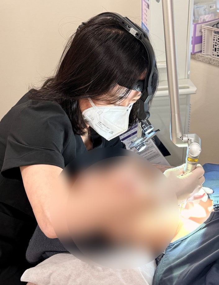 목 부위에 있는 편평사마귀를 제거해드리고 있는 모습입니다.