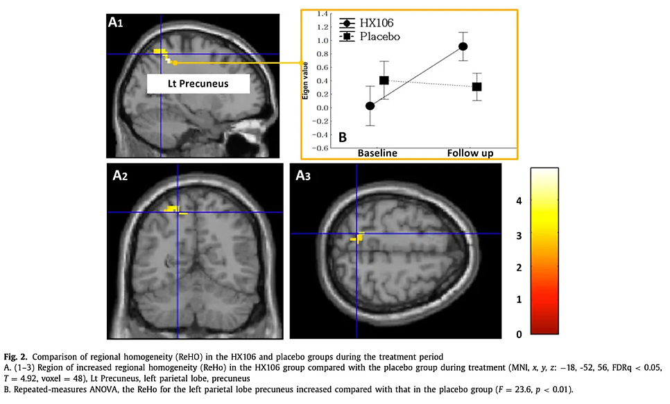 BAE, Sujin; PARK, Sunhye; HAN, Doug Hyun. A mixed herbal extract as an adjunctive therapy for attention deficit hyperactivity disorder: a randomized placebo-controlled trial. Integrative medicine research, 2021, 10.3: 100714.