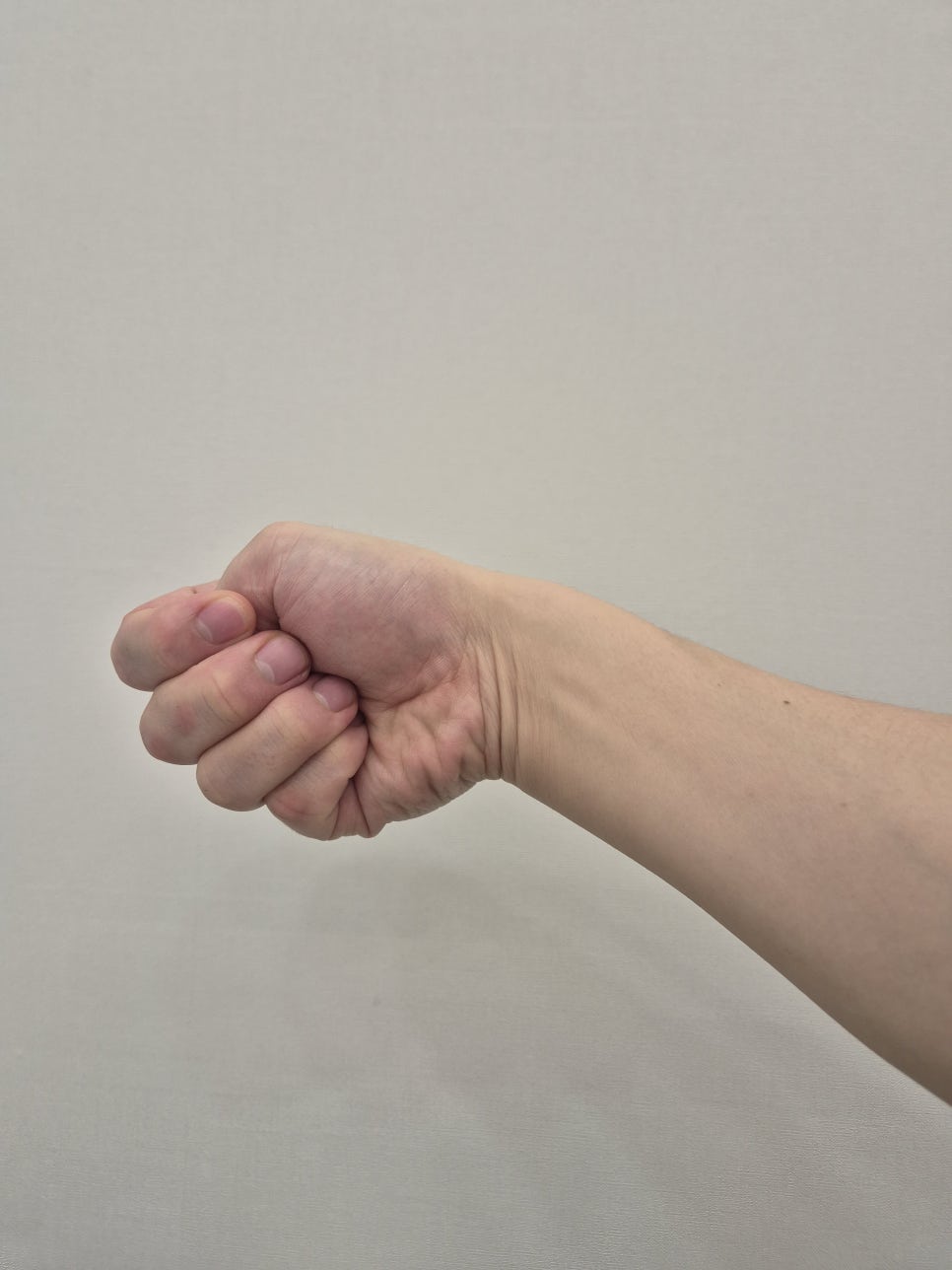 Finkelstein's test