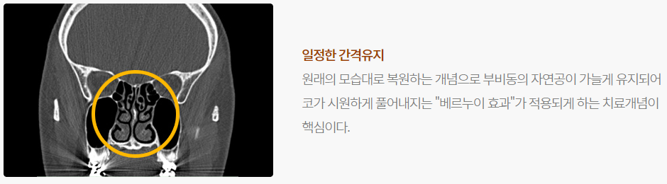 코숨치료 이후의 코 (코숨한의원 네트워크의 치료 http://cosoom.icoo.kr/page/medical01)