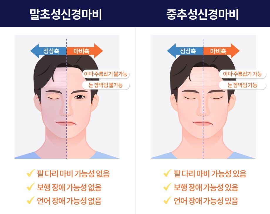 https://www.mokhuri.com/facialpalsy/03_symptom/symptom01.php