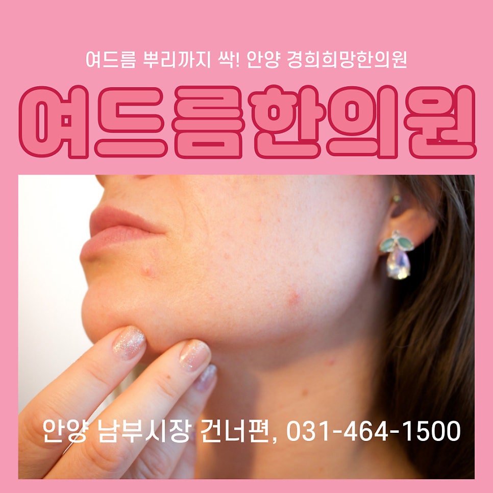 안양여드름한의원 경희희망 / Pixabay로부터 입수된 Kjerstin Michaela Noomi Sakura Gihle Martinsen Haraldsen님의 이미지 입니다.