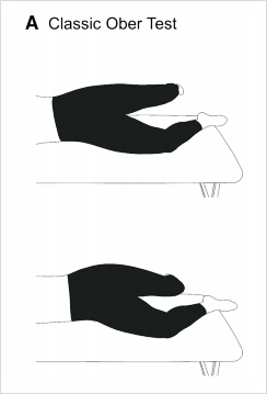 Ober test출처: The Iliotibial Band: A Complex Structure with Versatile Functions - L. A. Hutchinson 등