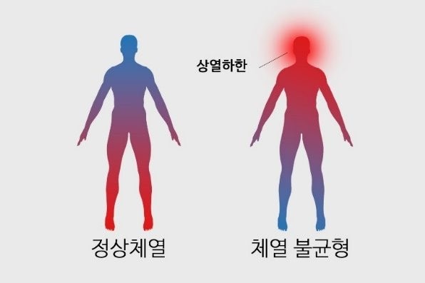 출처: https://m.blog.naver.com/danaslclinic/221888984266