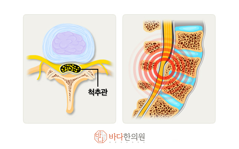 이미지 출처 : 국가건강정보포털