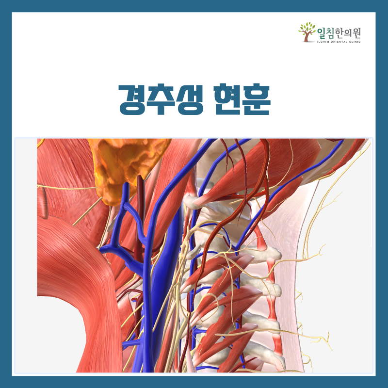 목을 통해서 머리로 올라가는 혈관, 목에서 뻗어나오는 신경과 머리로 올라가는 신경 가지들로 인해서 증상이 유발됩니다. 그것들을 해결하는 과정의 핵심은 표층부의 근육뿐만 아니라 심층부의 근육들과 인대를 풀어주며, 경추배열을 정상화시키고 상부경추 디스크에 걸려있는 압력을 줄여주는 것입니다.