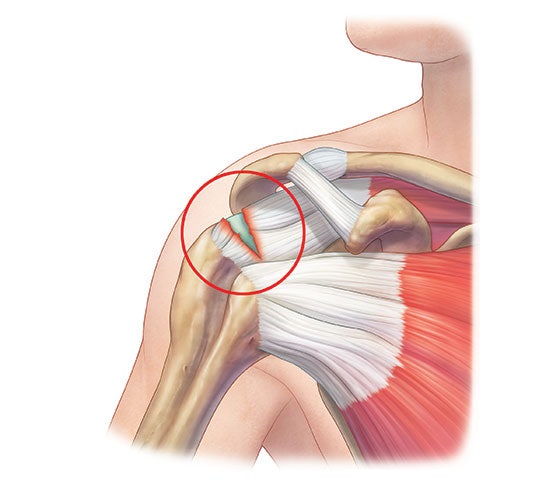 https://allspine.com/joint/joint02/joint02_01.html?tcs_cate3=B-1-1
