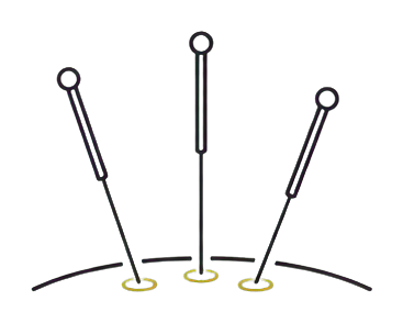 acupuncture.png