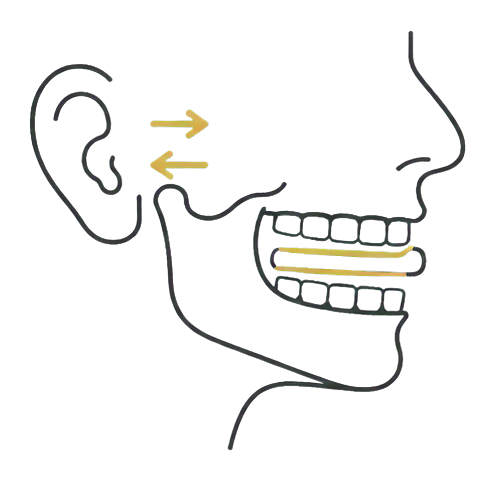tmj-device.png