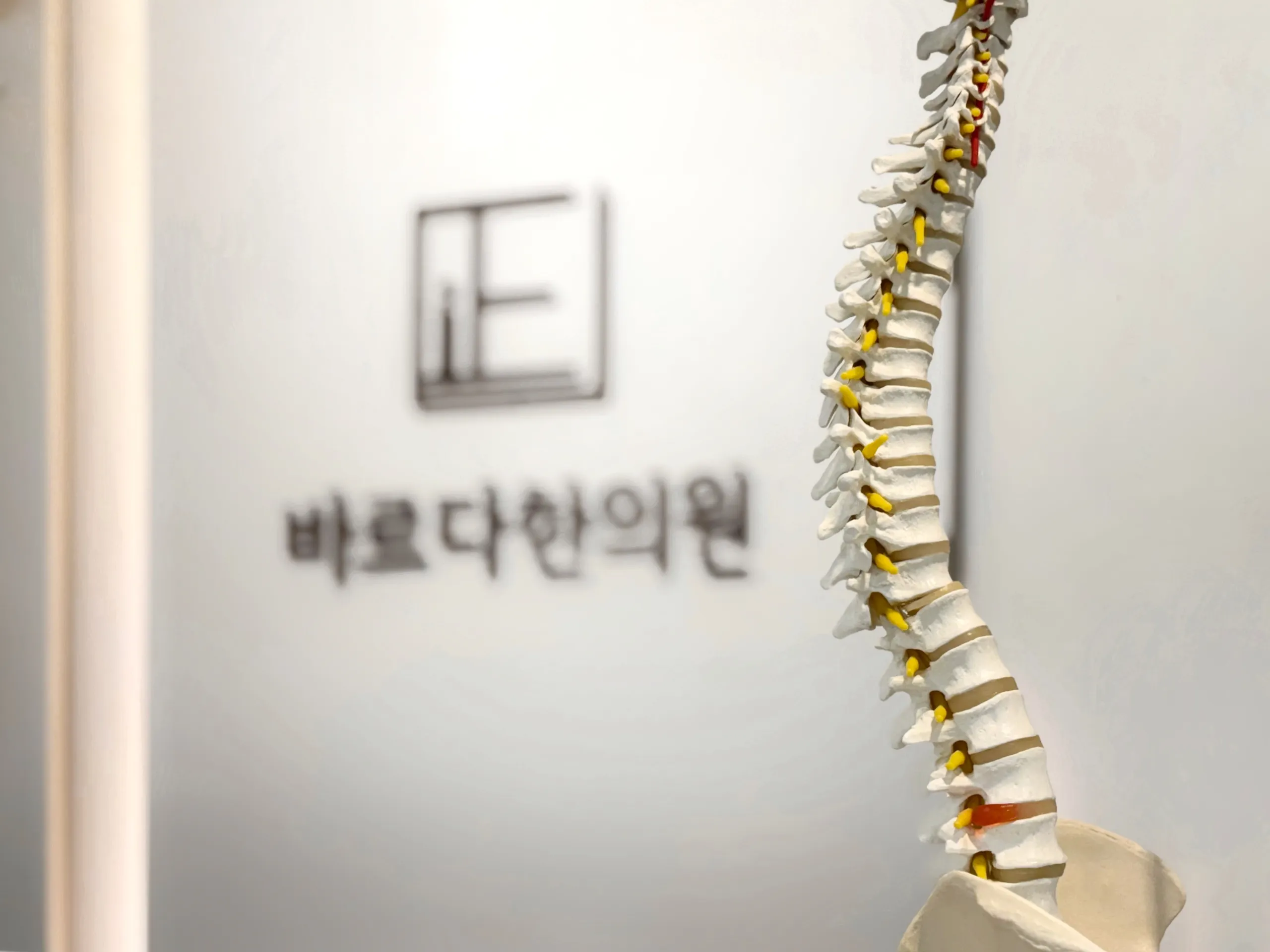 척추뼈모형1 (11).webp