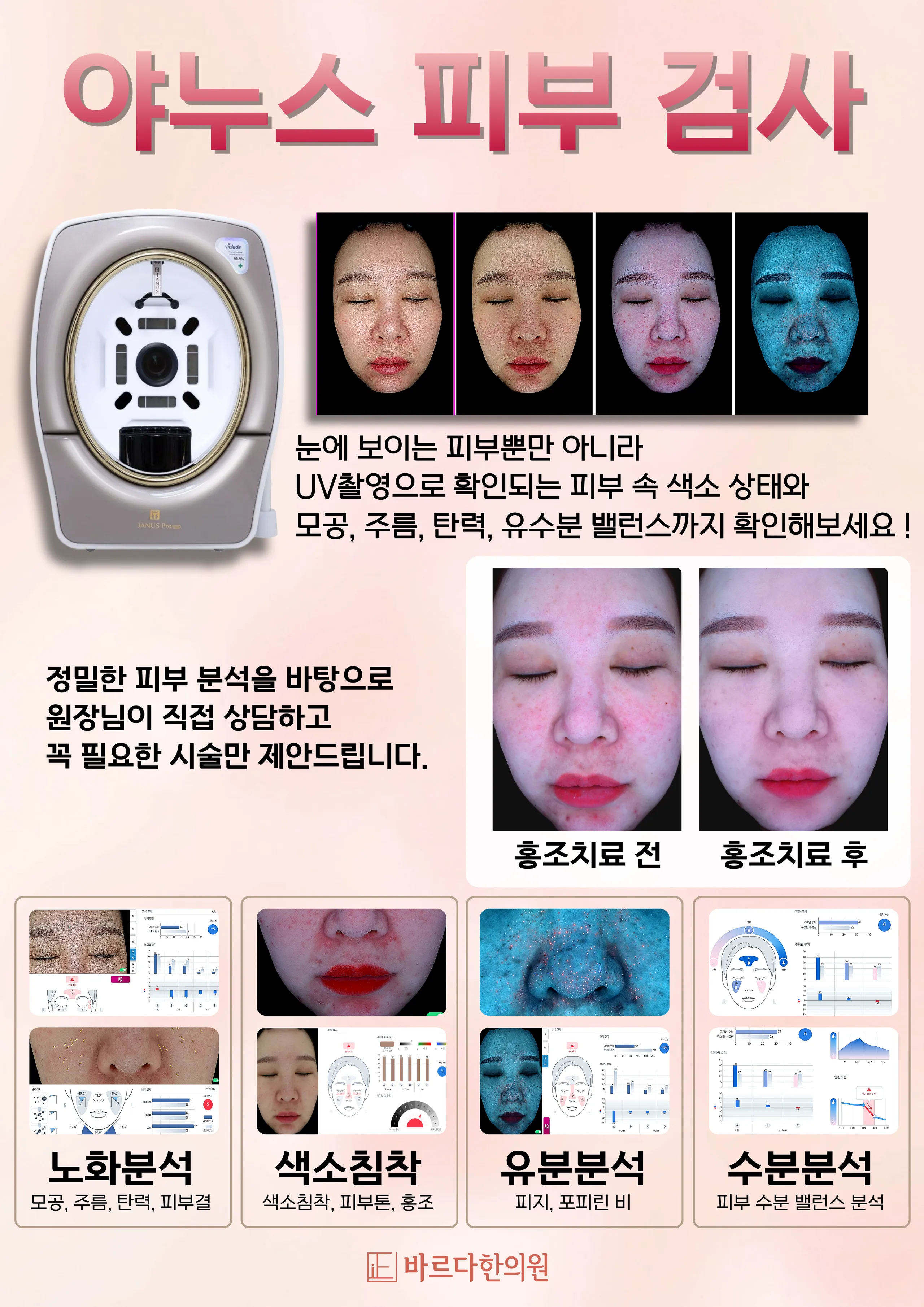 피부검사안내.png