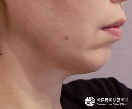 온다 8만줄 전1.png