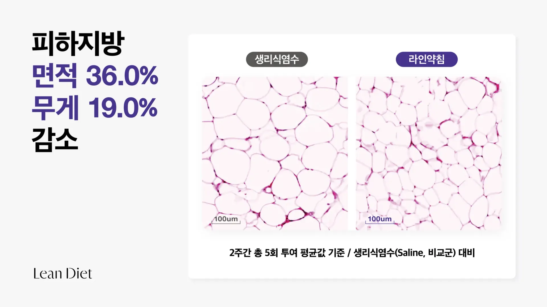 아큐렉스_라인_사이니지_가로4.webp